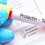 Prolaktyna i testosteron