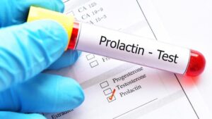 Prolaktyna i testosteron